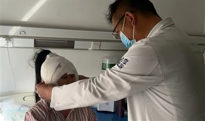 Mitä eroa MCR -komposiittikeskuksen ja perinteisen kasvojenkorotusleikkauksen...